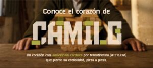 ‘Camilo’ da voz a los pacientes con amiloidosis cardiaca por transtiretina