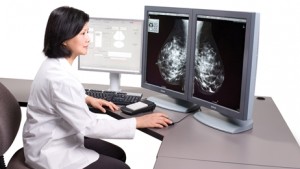 Cribados de cáncer de mama en Andalucía: Al menos 2.000 mujeres no fueron notificadas tras mamografías “no concluyentes”