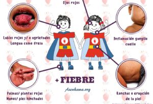 Detectar la enfermedad de Kawasaki a tiempo para evitar secuelas cardiacas de por vida