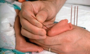 Expertos reivindican una Estrategia de Detección Precoz de la Hipercolesterolemia Familiar mediante la medición del colesterol en el cribado neonatal