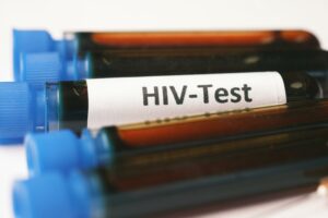 VIH en mujeres en España: menor incidencia , pero más diagnóstico tardío y desafíos específicos en prevención y tratamiento