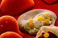 El VIH puede diagnosticarse con un test de saliva
