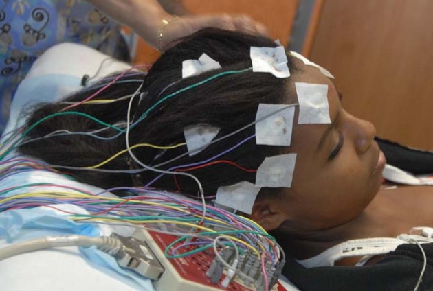 electroencefalograma diagnóstico epilepsia
