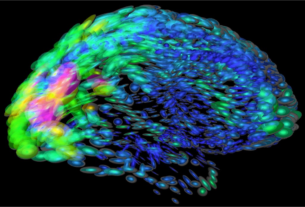 representación del cerebro humano