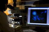 Cuatro de cada 10 nuevos medicamentos aprobados son para enfermedades raras Cuatro de cada 10 nuevos medicamentos aprobados son para enfermedades raras