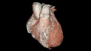 3D_Heart_application_spotlight
