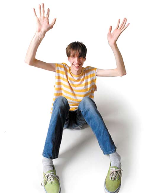 Resultado de imagen de sindrome de marfan