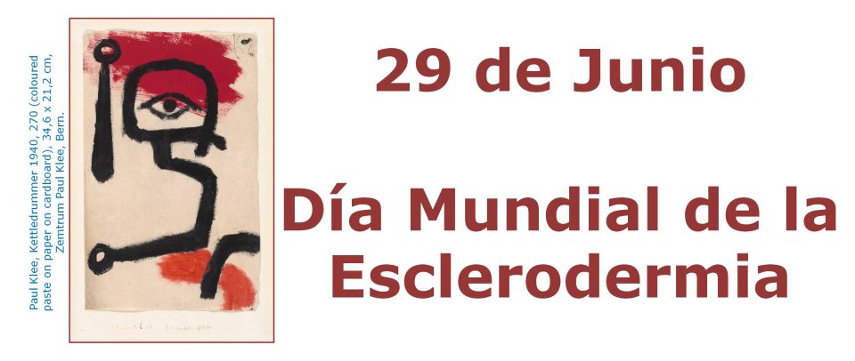 Este lunes, 'Descubriendo la esclerodermia' en el Día Mundial de la enfermedad | Somos Pacientes