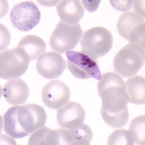 Plasmodium falciparum