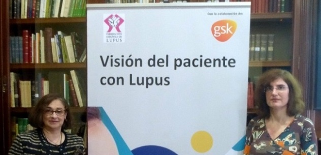 La fatiga y el dolor muscular son los síntomas más molestos del lupus