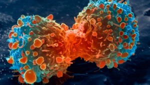 división de una célula de cáncer de pulmón