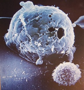Célula tumoral y célula NK