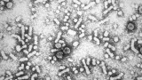 Los virus de la hepatitis causan cada año 1,45 millones de muertes