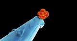 Corrigen una enfermedad hereditaria en embriones humanos Corrigen una enfermedad hereditaria en embriones humanos