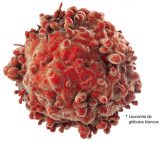 Los nuevos tratamientos contra el cáncer están cambiando favorablemente el sino de la batalla contra la enfermedad Los nuevos tratamientos contra el cáncer están cambiando favorablemente el sino de la batalla contra la enfermedad