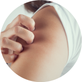 Dermatitis atópica, mucho más que un picor Dermatitis atópica, mucho más que un picor