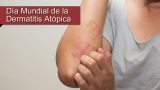 Este sábado se celebra el Día Mundial de la Dermatitis Atópica