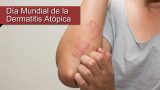 Este sábado se celebra el Día Mundial de la Dermatitis Atópica Este sábado se celebra el Día Mundial de la Dermatitis Atópica