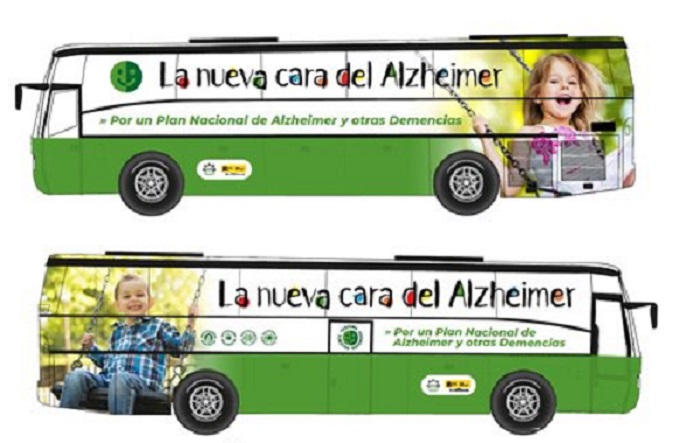 La nueva cara del Alzheimer