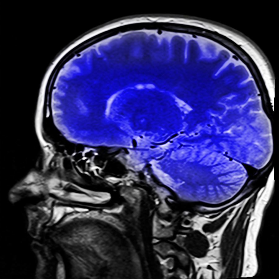 Actividades para un Cerebro Activo