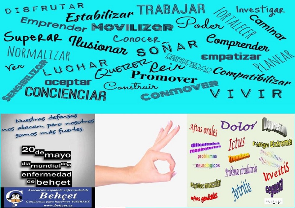 Reto para visibilizar la enfermedad de Behçet