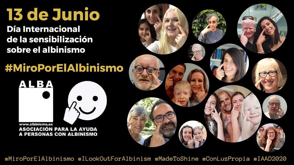 Contra la discriminación de las personas con albinismo