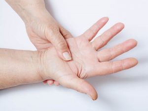 esclerodermia