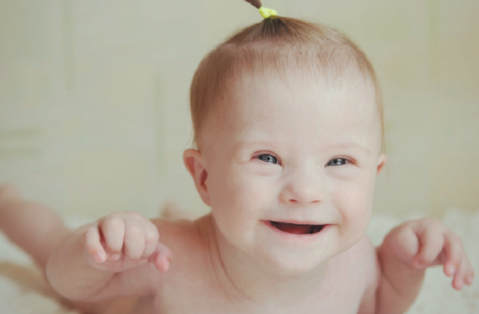 Guías sobre el síndrome de Down para nuevos y futuros padres