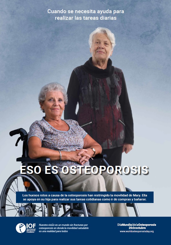Osteoporosis, un asunto familiar