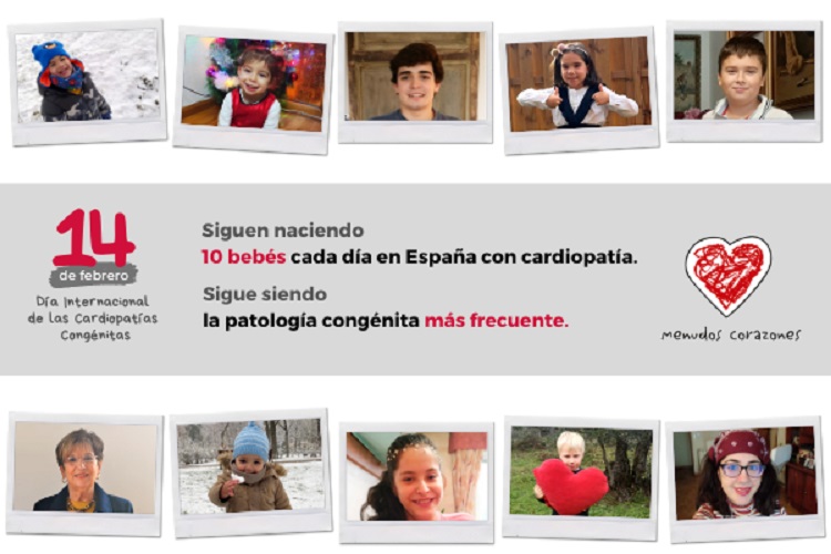 Cada año nacen en España 4.000 niños con cardiopatías congénitas