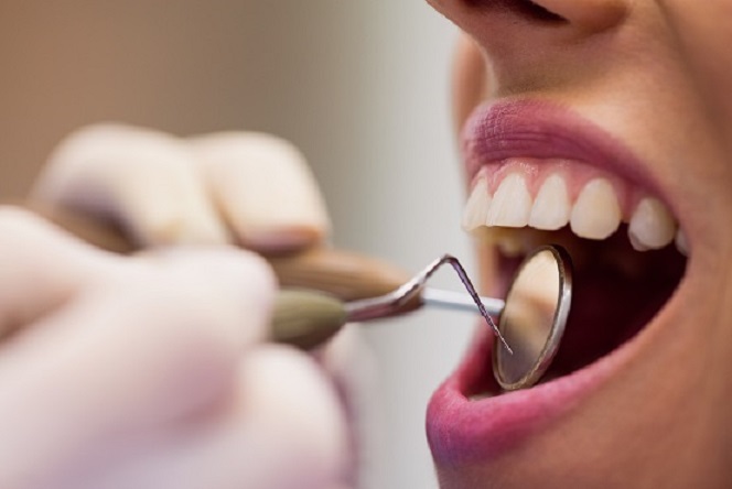 Cuidado de la salud bucodental en la parálisis cerebral
