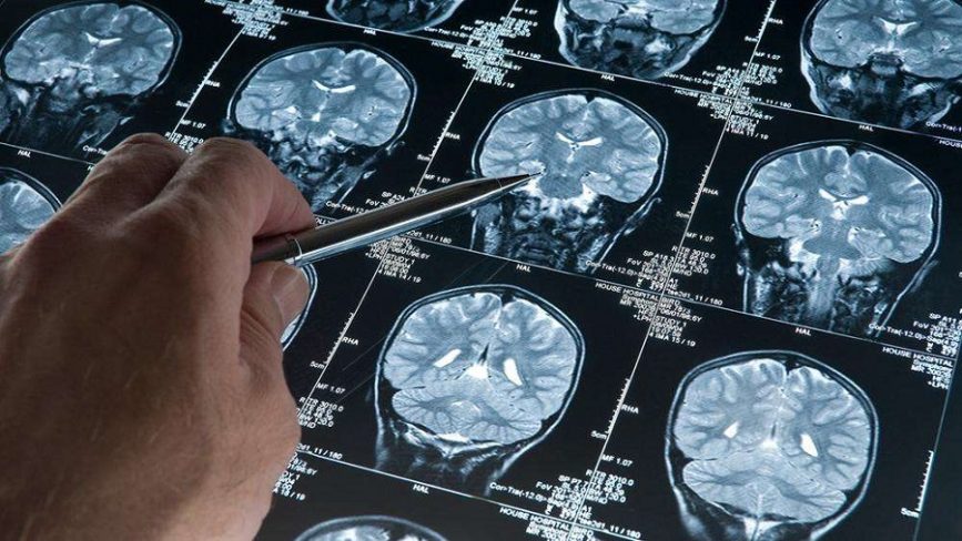 Detección precoz y diagnóstico temprano para salvaguardar la calidad de vida y autonomía en el alzhéimer