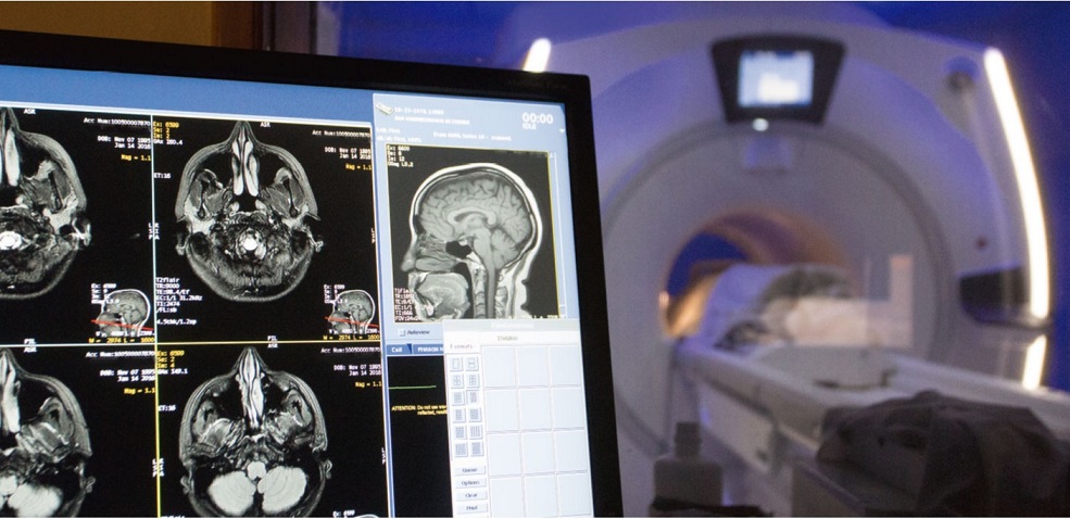 La imagen clínica en el diagnóstico de las enfermedades raras