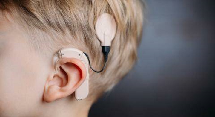 Implantes cocleares para todos los que los necesiten
