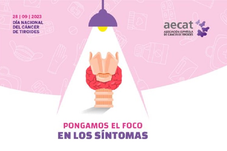 Cáncer de tiroides: pongamos el foco en los síntomas