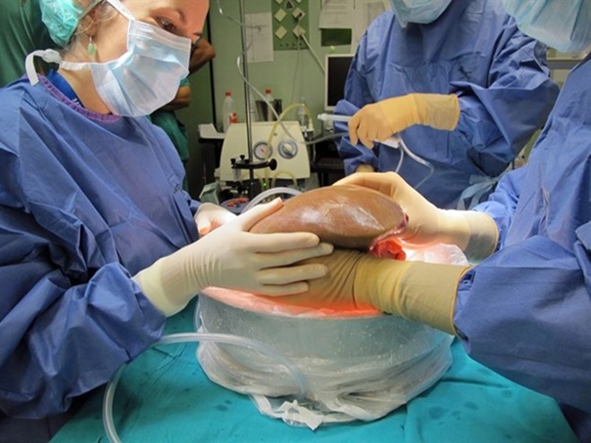 Guía de trasplante hepático para pacientes y familiares