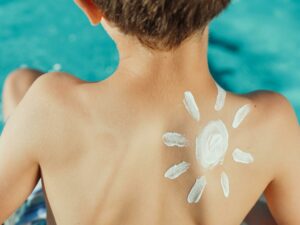 melanoma