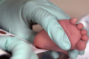 cribado neonatal