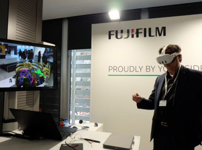 Planificación quirúrgica con imagen 3D e IA para mejorar la seguridad del paciente