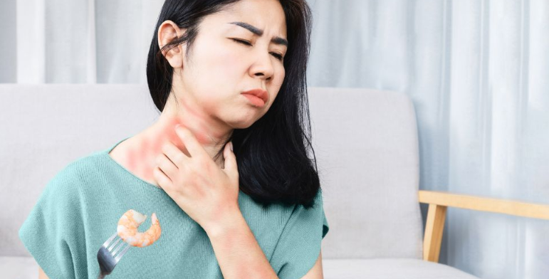 Aumentan los casos de anafilaxia en España y los expertos advierten sobre su infradiagnóstico