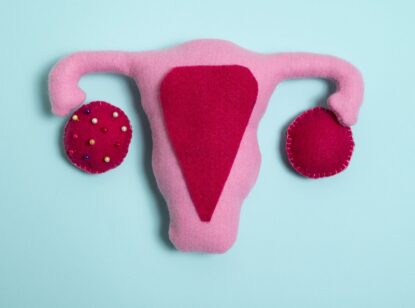 La genética y la obesidad infantil influyen en el Síndrome del Ovario Poliquístico