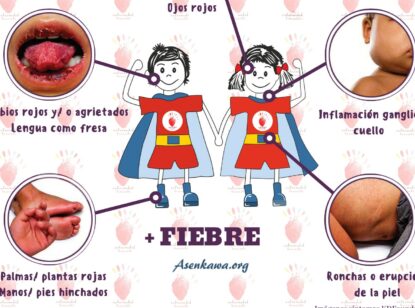Detectar la enfermedad de Kawasaki a tiempo para evitar secuelas cardiacas de por vida