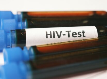 VIH en mujeres en España: menor incidencia , pero más diagnóstico tardío y desafíos específicos en prevención y tratamiento